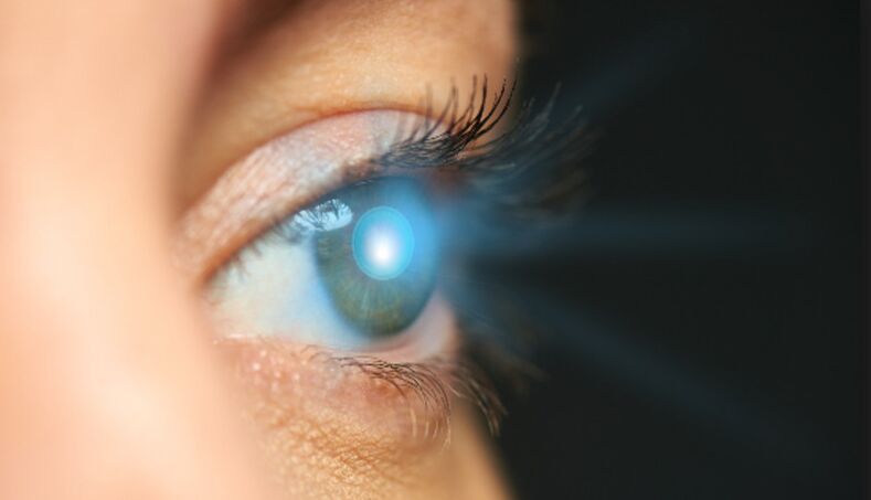 Göz çevresindeki cildin lazerle gençleştirilmesi